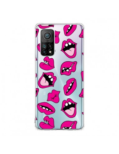 Coque Xiaomi Mi 10T / 10T Pro Lèvres Lips Bouche Kiss Transparente - Claudia Ramos