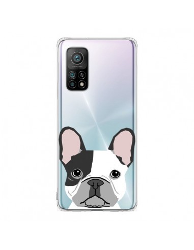 Coque Xiaomi Mi 10T / 10T Pro Bulldog Français Chien Transparente - Pet Friendly