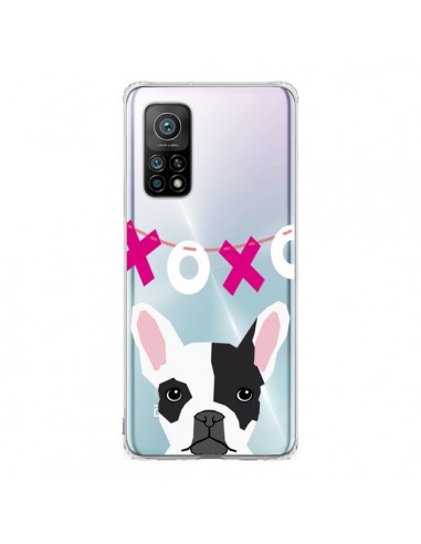 Coque Xiaomi Mi 10T / 10T Pro Bulldog Français XoXo Chien Transparente - Pet Friendly