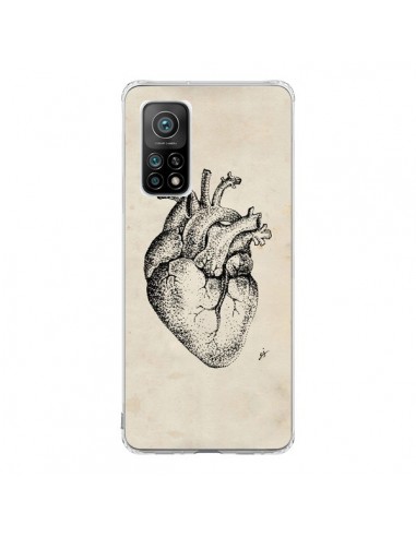 Coque Xiaomi Mi 10T / 10T Pro Coeur Vintage - Tipsy Eyes