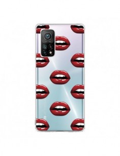 Coque Xiaomi Mi 10T / 10T Pro Lèvres Rouges Lips...