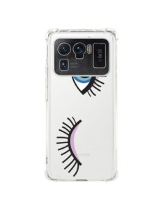 Coque Xiaomi Mi 11 Ultra Eyes Oeil Yeux Bleus...