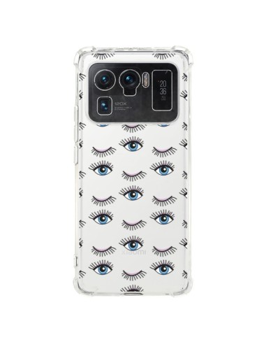 Coque Xiaomi Mi 11 Ultra Eyes Oeil Yeux Bleus Mosaïque Transparente -  Léa Clément