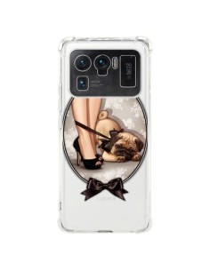 Coque Xiaomi Mi 11 Ultra Lady Jambes Chien Bulldog Dog...