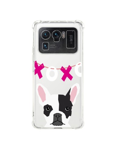 Coque Xiaomi Mi 11 Ultra Bulldog Français XoXo Chien Transparente - Pet Friendly