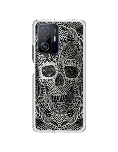 Xiaomi 11T / 11T Pro Case Skull Lace - Ali Gulec