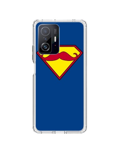 Coque Xiaomi 11T / 11T Pro Super Moustache Movember Superman - Bertrand Carriere