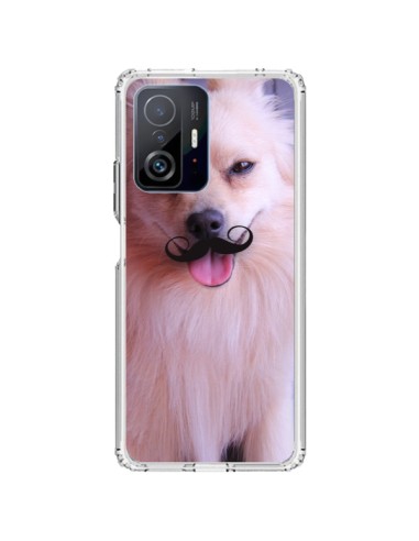 Coque Xiaomi 11T / 11T Pro Clyde Chien Movember Moustache - Bertrand Carriere