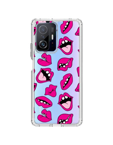 Coque Xiaomi 11T / 11T Pro Lèvres Lips Bouche Kiss Transparente - Claudia Ramos