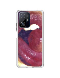 Coque Xiaomi 11T / 11T Pro Lollipop Lolita - Daniel Vasilescu