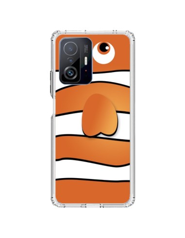 Coque Xiaomi 11T / 11T Pro Nemo - Nico