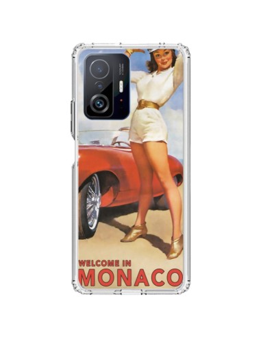 Coque Xiaomi 11T / 11T Pro Welcome to Monaco Vintage Pin Up - Nico