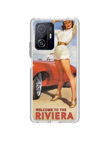 Coque Xiaomi 11T / 11T Pro Welcome to the Riviera Vintage Pin Up - Nico