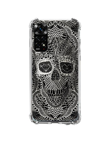 Xiaomi Redmi Note 11 / 11S Case Skull Lace - Ali Gulec