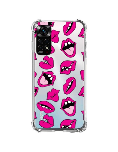 Cover Xiaomi Redmi Note 11 / 11S Labbra Bacio Trasparente - Claudia Ramos