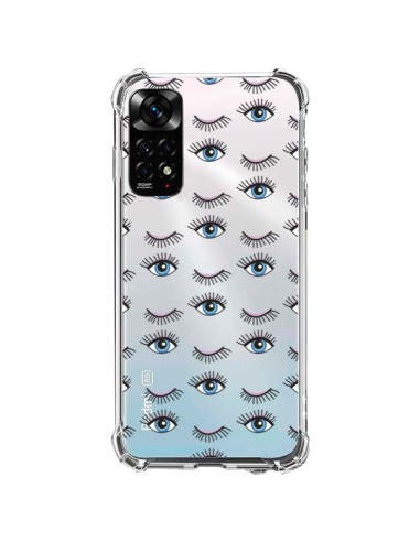 Xiaomi Redmi Note 11 / 11S Case Eyes Blue Mosaic Clear - Léa Clément