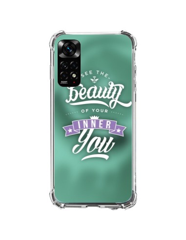 Coque Xiaomi Redmi Note 11 / 11S Beauty Vert - Javier Martinez