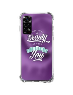 Coque Xiaomi Redmi Note 11 / 11S Beauty Violet - Javier Martinez