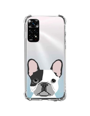 Xiaomi Redmi Note 11 / 11S Case Bulldog Dog Clear - Pet Friendly