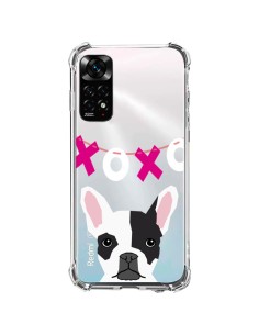 Coque Xiaomi Redmi Note 11 / 11S Bulldog Français XoXo Chien Transparente - Pet Friendly