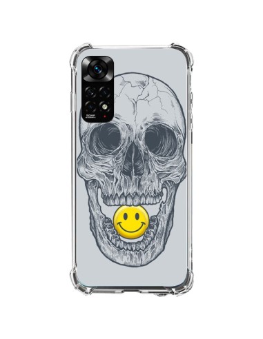 Xiaomi Redmi Note 11 / 11S Case Smiley Face Skull - Rachel Caldwell