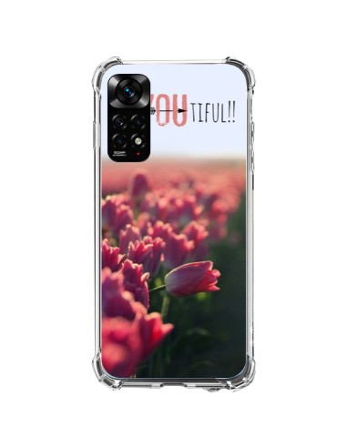 Coque Xiaomi Redmi Note 11 / 11S Coque iPhone 6 et 6S Be you Tiful Tulipes - R Delean