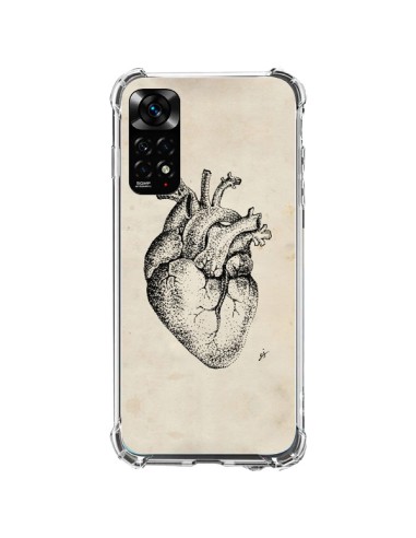 Coque Xiaomi Redmi Note 11 / 11S Coeur Vintage - Tipsy Eyes