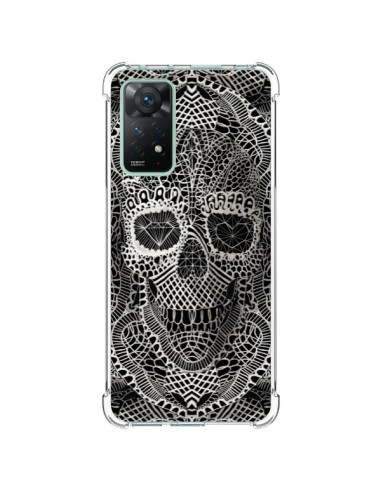 Coque Xiaomi Redmi Note 11 Pro Skull Lace Tête de Mort - Ali Gulec