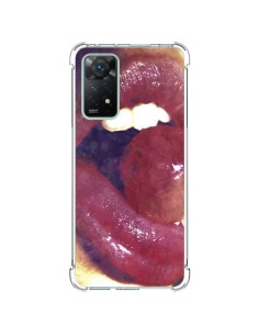 Xiaomi Redmi Note 11 Pro Case Lollipop Lolita - Daniel Vasilescu