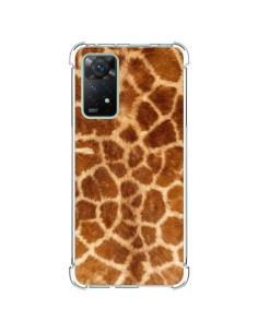 Coque Xiaomi Redmi Note 11 Pro Giraffe Girafe - Laetitia