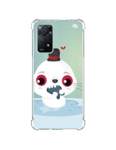 Xiaomi Redmi Note 11 Pro Case Foca - Maria Jose Da Luz