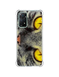 Xiaomi Redmi Note 11 Pro Case Cat Gato Loco - Maximilian San