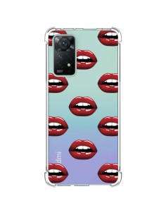 Xiaomi Redmi Note 11 Pro Case Lips Red Clear - Yohan B.